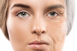 What are the Causes of Facial Sagging